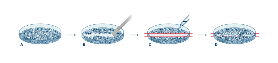 Wound Healing Assay